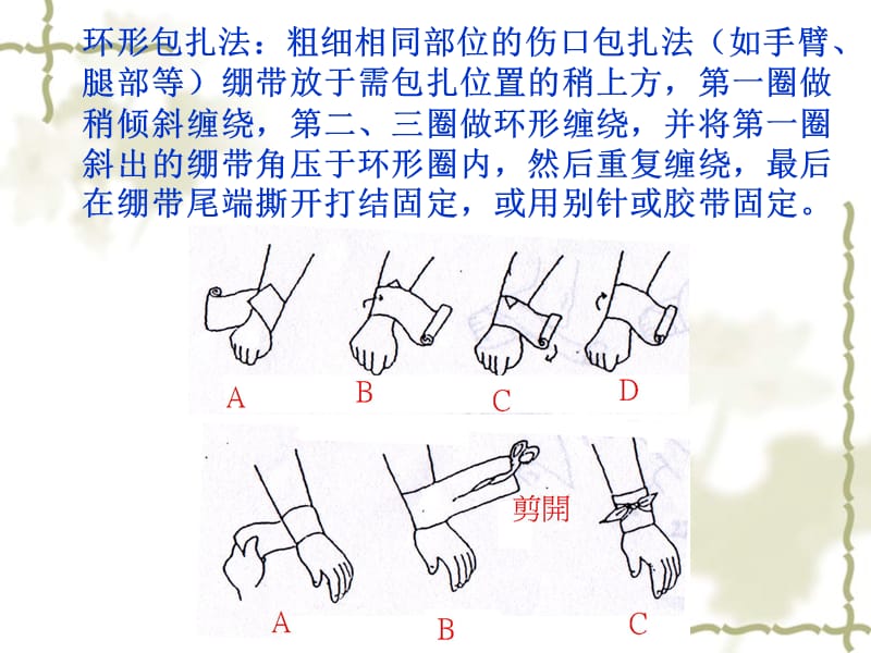 急救-包扎技术名师制作优质教学资料.ppt_第3页