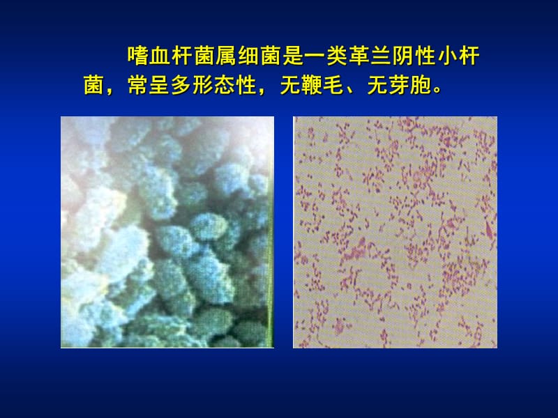 医学课件第15章嗜血杆菌属.ppt_第2页