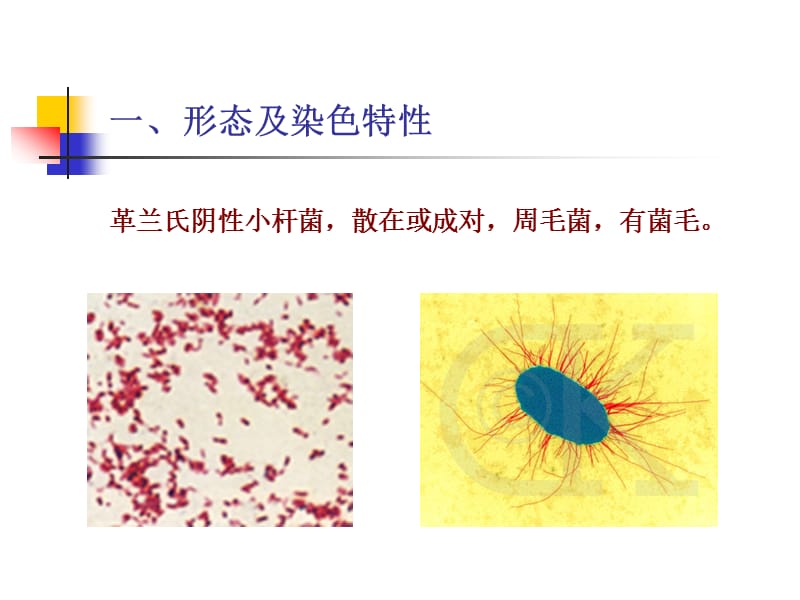 医学课件第二章肠杆菌科.ppt_第3页