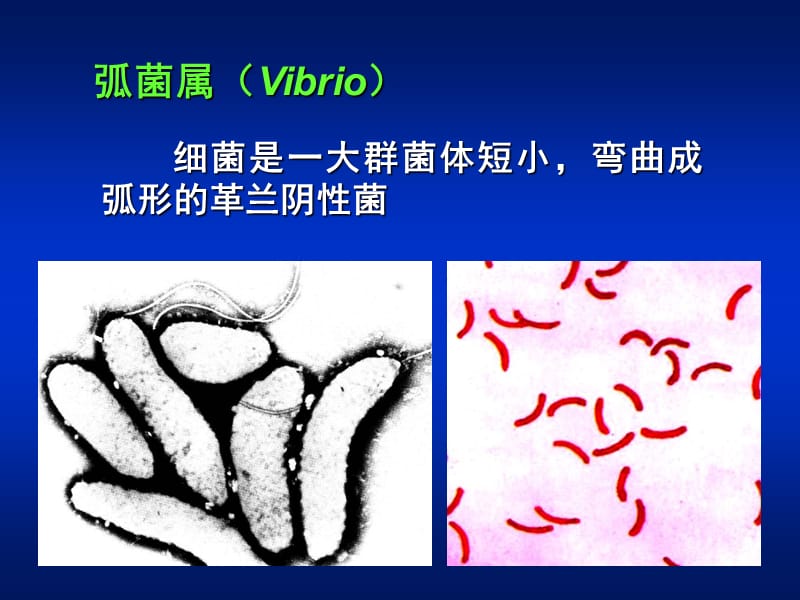 医学课件第11章弧菌属ppt课件.ppt_第2页