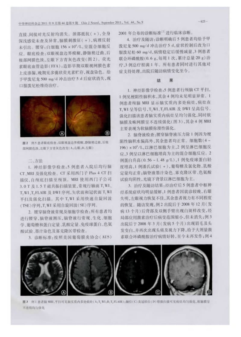 Vogt-小柳-原田综合征五例临床及神经影像学特点.pdf_第3页