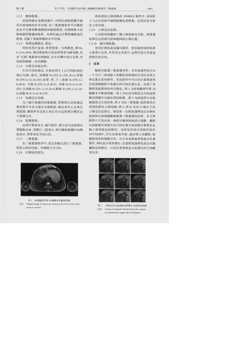 中国数字化可视人体腹腔内脏器官三维重建.pdf_第2页