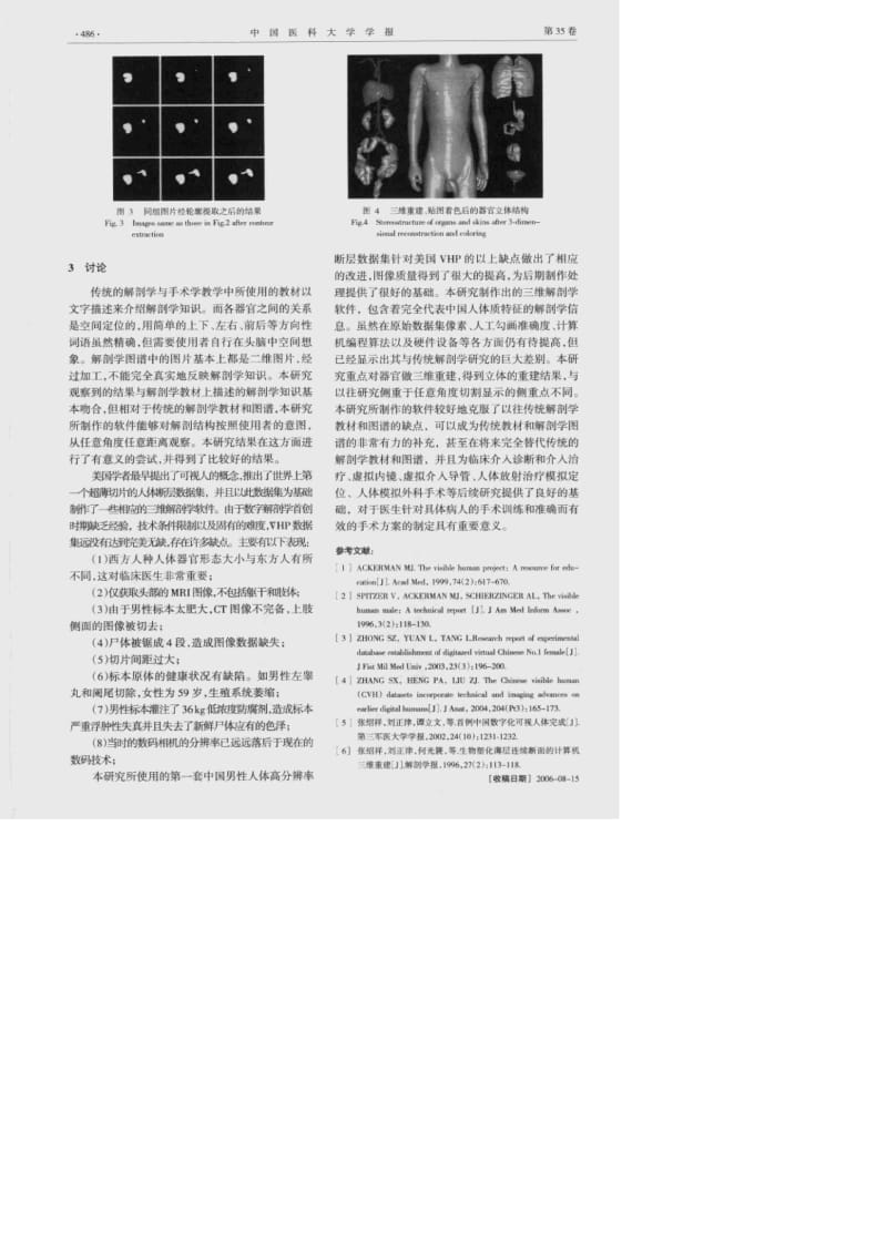 中国数字化可视人体腹腔内脏器官三维重建.pdf_第3页