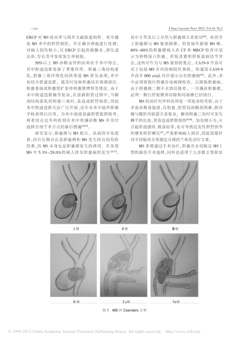 Mirizzi综合征_一个值得足够重视的临床疾患.pdf_第3页