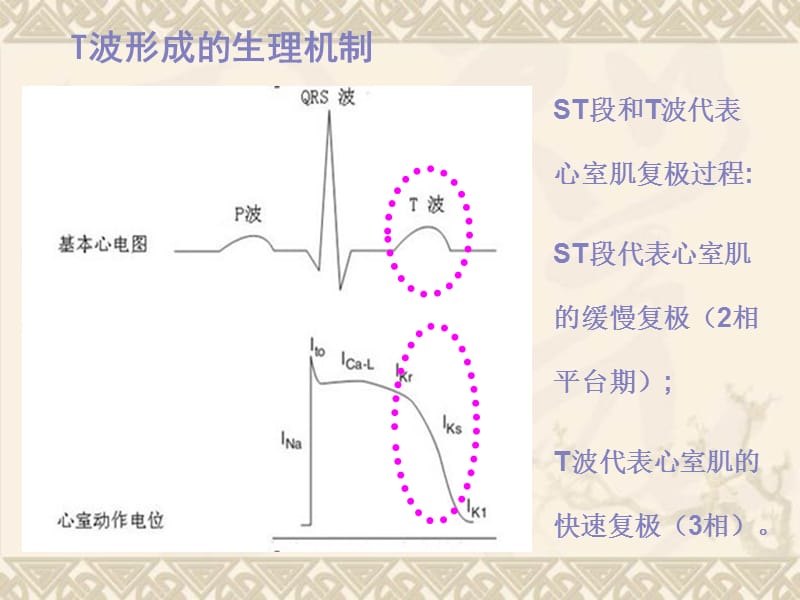 T波倒置的认识与诊断(2014年金华心血管年会).ppt_第1页