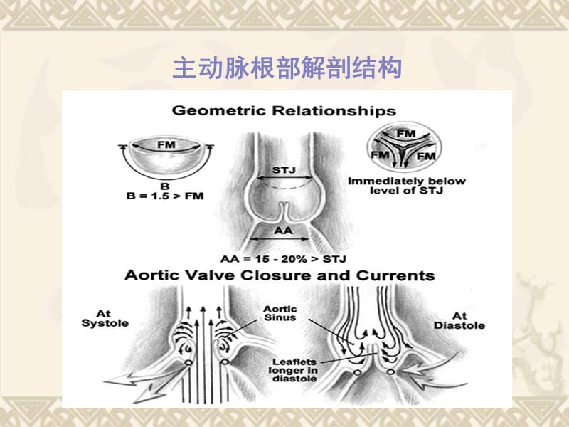 大血管外科.ppt_第2页