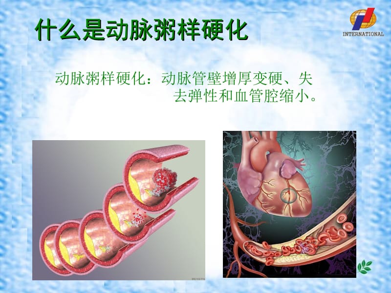 安利课件系列--心血管营养2-危险因素名师编辑PPT课件.ppt_第2页