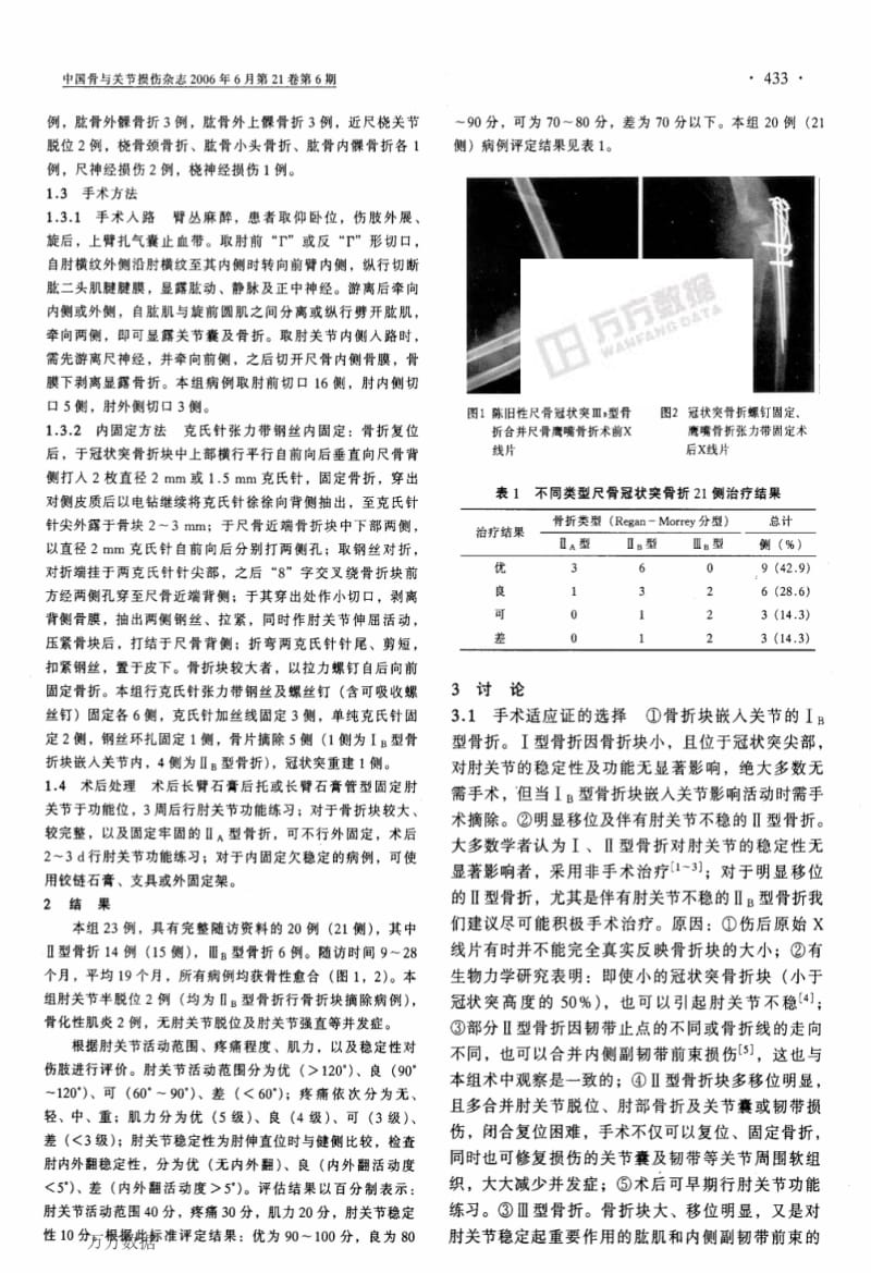尺骨冠状突骨折的手术治疗.pdf_第2页