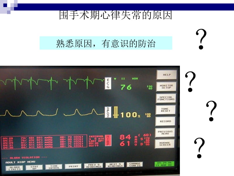 围手术期心律失常名师编辑PPT课件.ppt_第3页