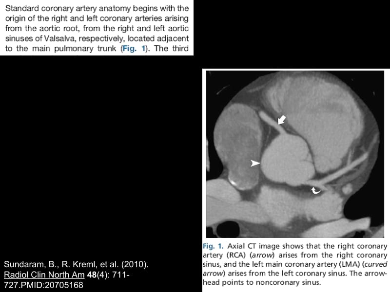 冠状动脉解剖(美国心脏病学会分段标准)名师编辑PPT课件.ppt_第2页