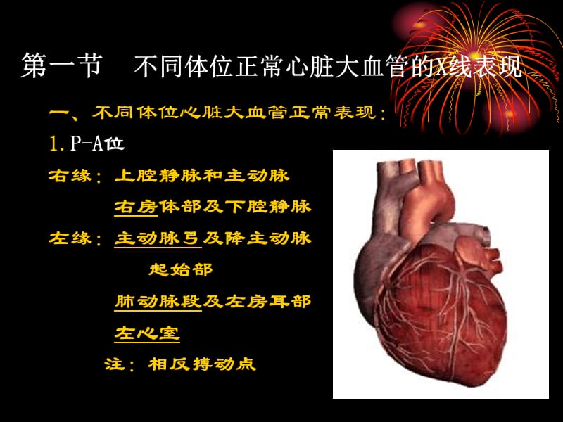 心脏大血管的影像表现名师编辑PPT课件.ppt_第2页