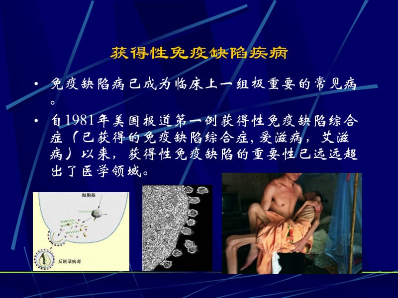 第十一章免疫缺陷名师编辑PPT课件.ppt_第3页