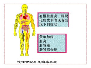 慢性重症临床表现名师编辑PPT课件.ppt