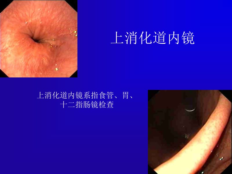 内镜的临床应用名师编辑PPT课件.ppt_第2页