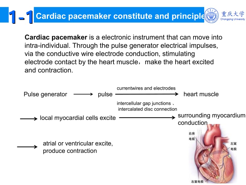 心脏起搏器q名师编辑PPT课件.ppt_第3页