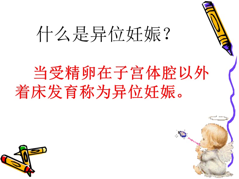 异位妊娠健教名师编辑PPT课件.ppt_第2页