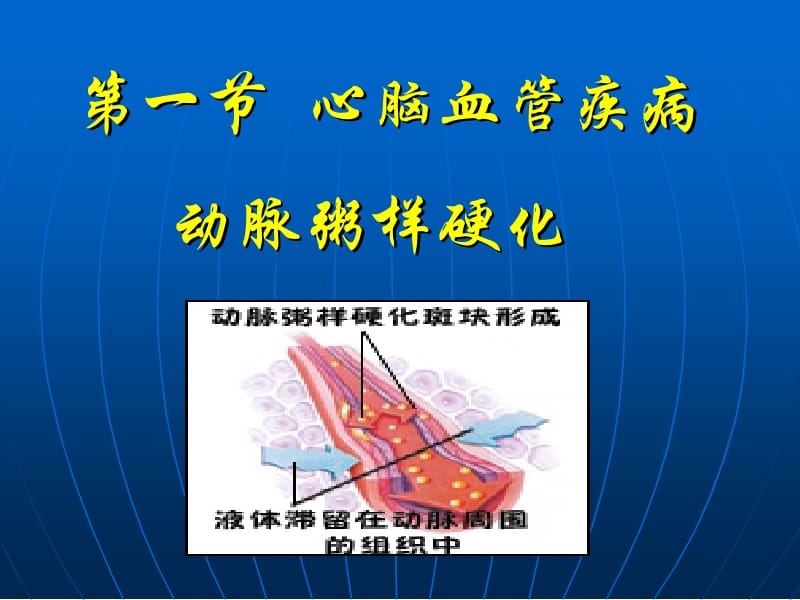 第五章营养与相关疾病名师编辑PPT课件.ppt_第3页