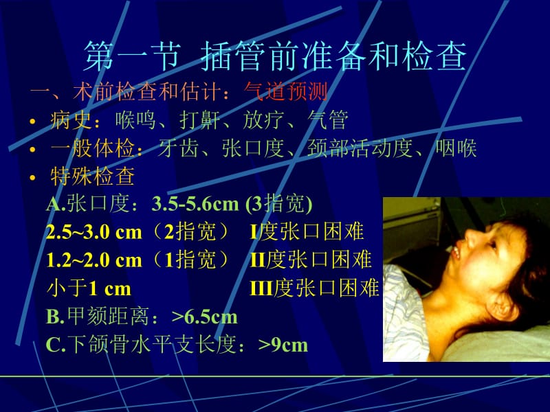 第4章气管插管名师编辑PPT课件.ppt_第3页