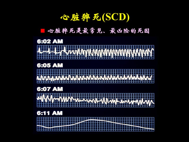 恶性室性心律失常的危险分层与治疗评价曹克将名师编辑PPT课件.ppt_第3页