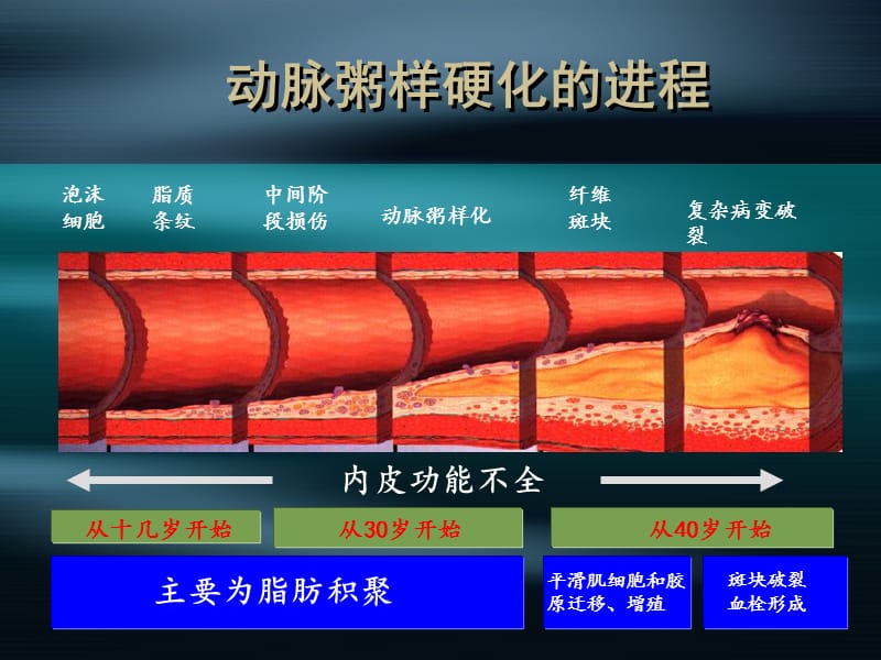 xh-4冠状动脉粥样硬化性心脏病名师编辑PPT课件.ppt_第3页