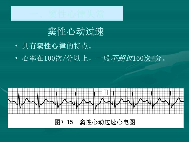 常见心律失常.ppt_第2页