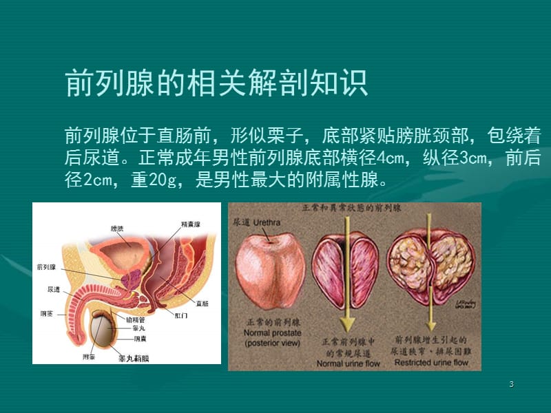 常见病知识讲座().ppt_第3页