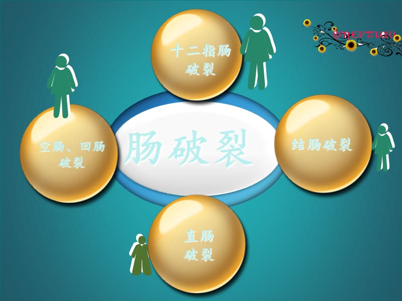 肠破裂的护理.ppt_第2页