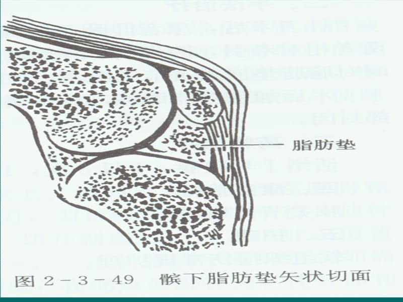 髌下脂肪垫损伤.ppt_第3页