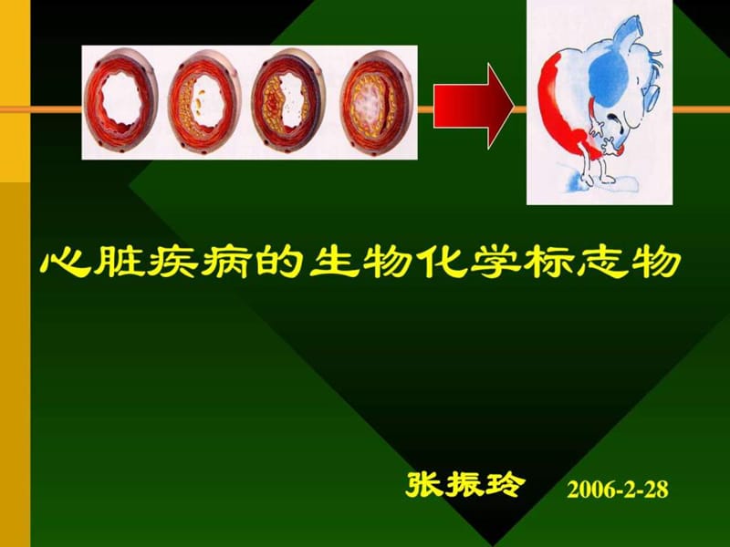 最新心脏疾病的生物化学标志物 (1)..ppt_第1页