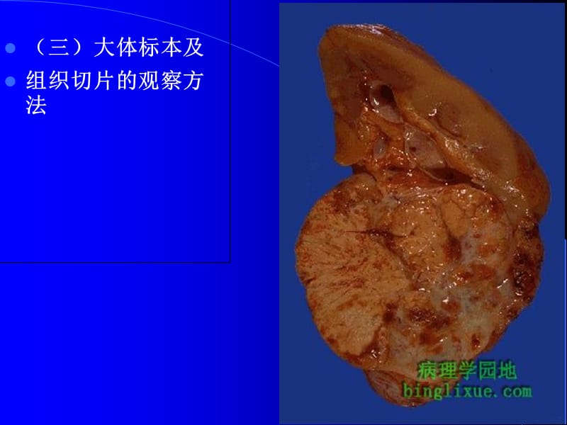 a第一次实验血液循环障碍-PPT文档.ppt_第3页