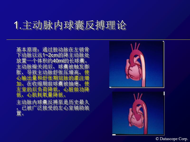 2018年主动脉内球囊反搏泵的临床使用-文档资料.ppt_第1页