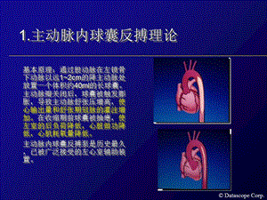 2018年主动脉内球囊反搏泵的临床使用-文档资料.ppt