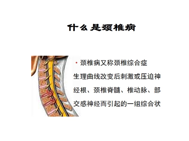 专家图解颈椎病的预防与保健-精选文档.ppt_第1页