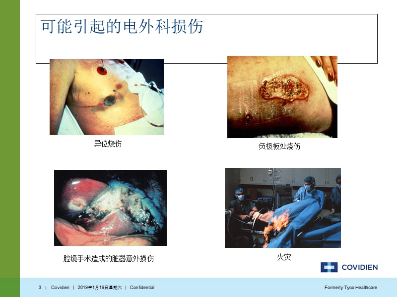 最新：Covidien电外科安全讲座-文档资料.ppt_第3页