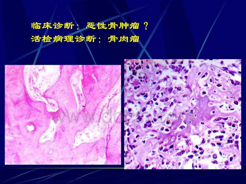 2018年中山医科大学病理学PPT课件第六章 肿瘤-文档资料.ppt_第3页