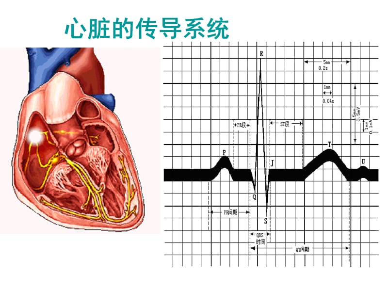 《心电图》-PPT文档.ppt_第3页