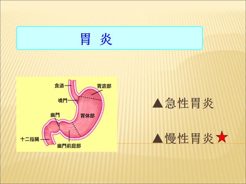 2018年慢性胃炎护理查房-文档资料.ppt_第1页