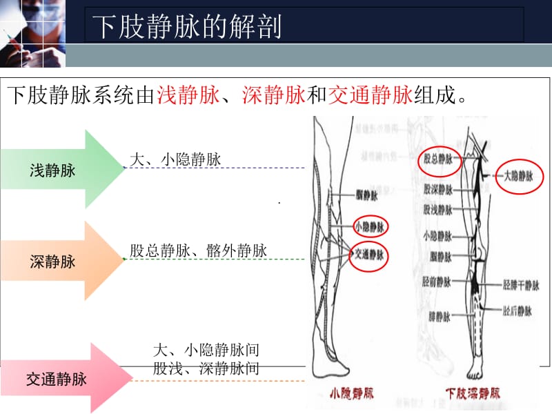 2018年下肢深静脉血栓的预防-文档资料.ppt_第2页