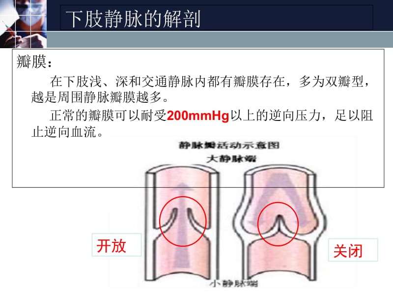 2018年下肢深静脉血栓的预防-文档资料.ppt_第3页