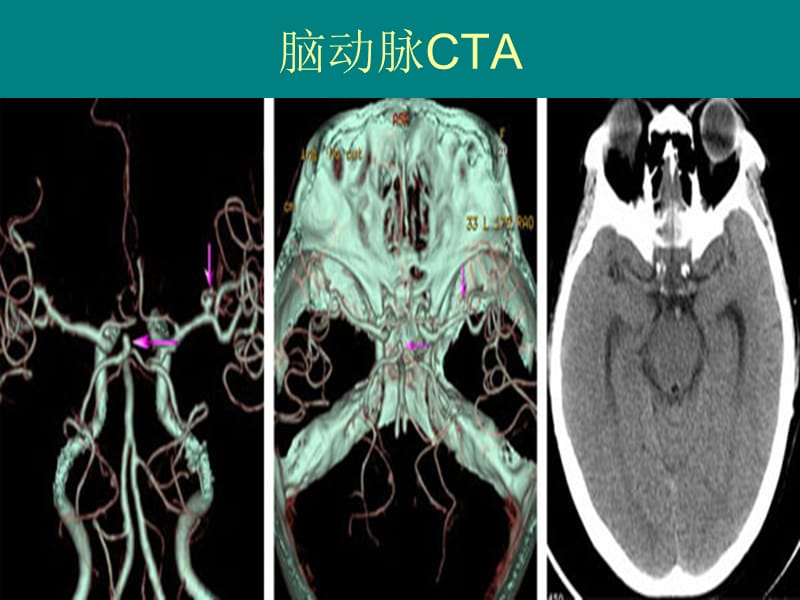 2018年多排螺旋CT临床-文档资料.ppt_第2页