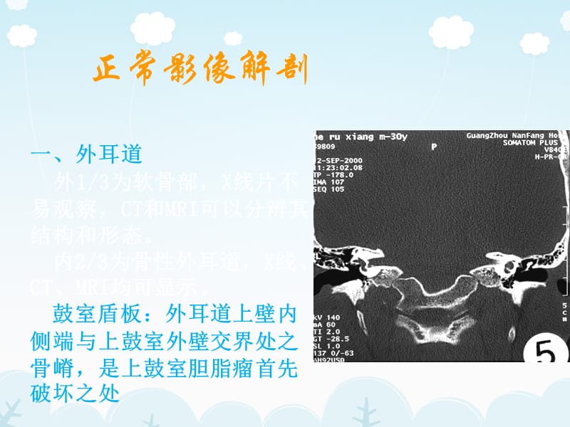 2018年医学影像-耳的影像解剖及常见疾病诊断-文档资料.ppt_第2页