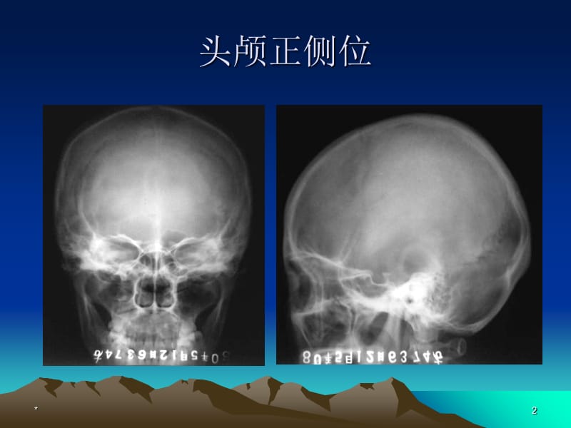 2018年中枢神经系统疾病-文档资料.ppt_第2页