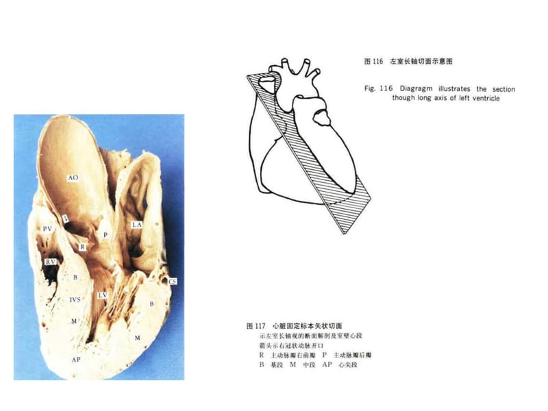 2018年心脏超声科室讲座-文档资料.ppt_第1页