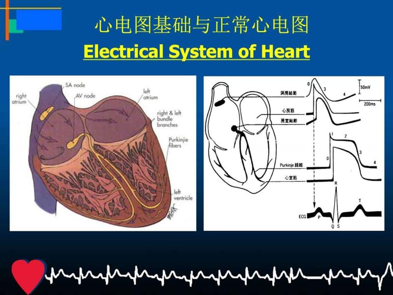 2018年心电图诊断与治疗-文档资料.ppt_第3页