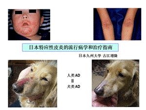 2018年日本AD的流行病学和治疗指南- 中文稿-文档资料.ppt