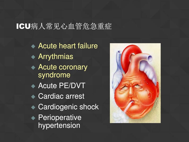 最新：ICU病人常见心血管危急重症处理-文档资料.ppt_第2页