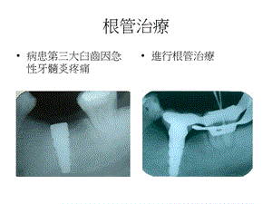 2018年【医药健康】牙髓病科病例-文档资料.ppt