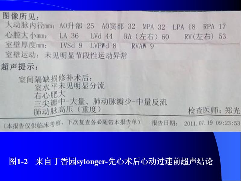 2018年P波的识别与相关病例讨论之四-文档资料.ppt_第2页