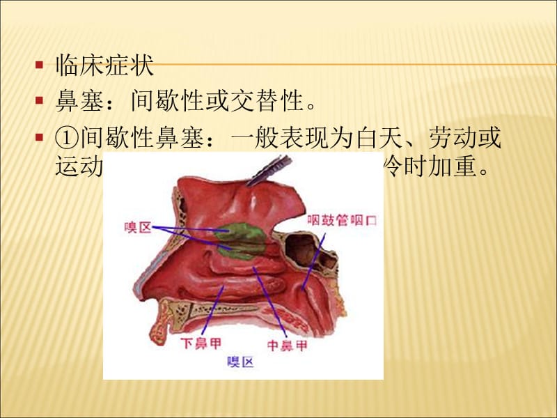 《五官科》PPT课件-精选文档.ppt_第2页