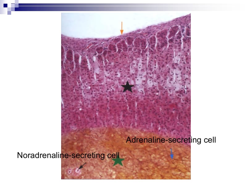 最新Adrenal meulla肾上腺髓质课件-PPT文档.ppt_第2页